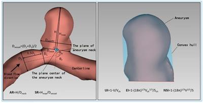 Assessing the risk of intracranial aneurysm rupture using computational fluid dynamics: a pilot study